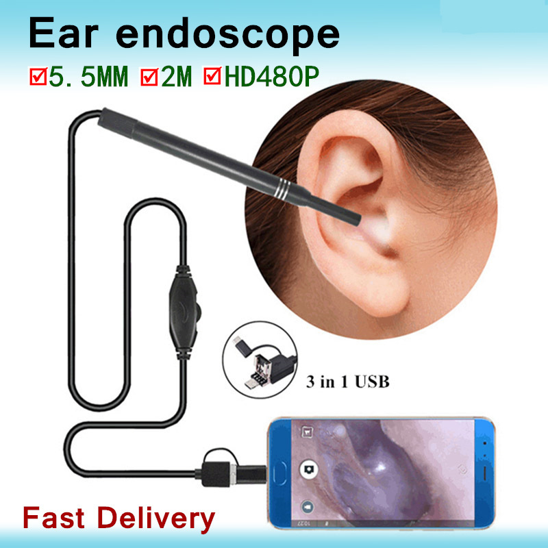 Smart Earwax Removal Tool with HD Camera – Visual Ear Cleaning Otoscope